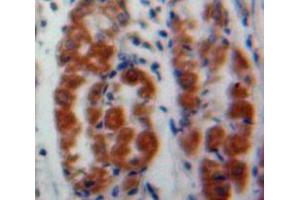IHC-P analysis of Stomach tissue, with DAB staining. (MAEA 抗体  (AA 136-379))