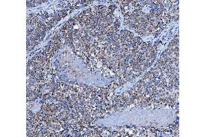 IHC analysis of TRK fused gene/TFG using anti-TRK fused gene/TFG antibody (ABIN7599839). (TFG 抗体  (AA 121-400))