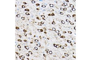 Immunohistochemistry of paraffin-embedded rat brain using RPL17 Rabbit pAb (ABIN6128342, ABIN6147115, ABIN6147116 and ABIN6221632) at dilution of 1:100 (40x lens). (RPL17 抗体  (AA 1-184))