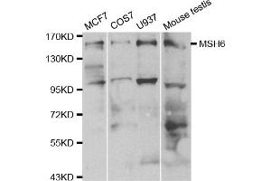 Western blot analysis of extracts of various cell lines, using MSH6 antibody (ABIN5970371) at 1/500 dilution.
