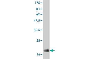 Western Blot detection against Immunogen (19. (IFNA2 抗体  (AA 24-188))
