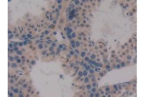 Immunohistochemistry (IHC) image for anti-Chemokine (C-X-C Motif) Ligand 16 (CXCL16) (AA 31-241) antibody (ABIN7442873)