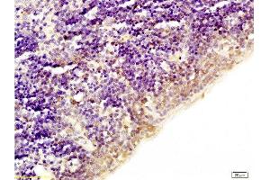 Immunohistochemistry (Paraffin-embedded Sections) (IHC (p)) image for anti-Histone H1 (acLys52) antibody (ABIN729973)