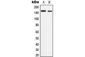 Western blot analysis of c-Met (pY1234) expression in A431 (A), HepG2 (B) whole cell lysates. (c-MET 抗体  (C-Term, pTyr1234))