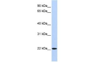 Western Blotting (WB) image for anti-Synovial Sarcoma, X Breakpoint 5 (SSX5) antibody (ABIN2458407) (SSX5 抗体)
