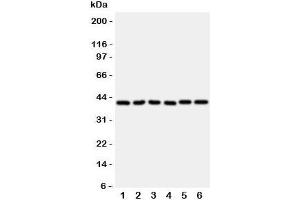 Western blot testing of WISP1 antibody and rat samples 1: heart;  2: kidney;  3: lung;  and human samples 4: A549;  5: A431;  6: COLO320 cell lysate (WISP1 抗体  (C-Term))