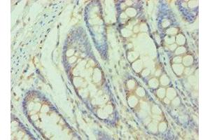 Immunohistochemistry of paraffin-embedded human colon tissue using ABIN7155523 at dilution of 1:100 (SMYD3 抗体  (AA 199-428))