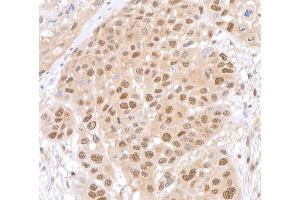 Immunohistochemistry (IHC) image for anti-HECT, UBA and WWE Domain Containing 1, E3 Ubiquitin Protein Ligase (HUWE1) (AA 2250-2300) antibody (ABIN7455157)