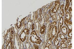 ABIN6279256 at 1/100 staining Mouse kidney tissue by IHC-P. (CPXM2 抗体)