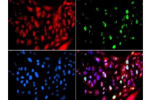 Immunofluorescence analysis of GFP-RNF168 transgenic U2OS cells using UIMC1 antibody (ABIN5974363). (UIMC1 抗体)