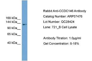 WB Suggested Anti-CCDC146  Antibody Titration: 0. (CCDC146 抗体  (Middle Region))