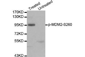 Western Blotting (WB) image for anti-Mdm2, p53 E3 Ubiquitin Protein Ligase Homolog (Mouse) (MDM2) (pSer450) antibody (ABIN1870424) (MDM2 抗体  (pSer450))
