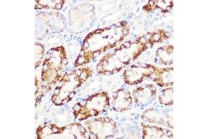Immunohistochemistry of paraffin-embedded mouse kidney using  Rabbit mAb (ABIN7265591) at dilution of 1:100 (40x lens). (ANGPTL3 抗体)