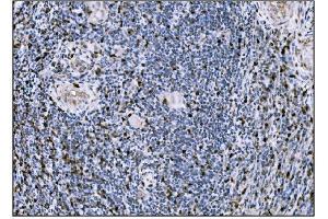 IHC analysis of Fos B/FOSB using anti-Fos B/FOSB antibody (ABIN7599279). (FOSB 抗体  (AA 1-332))