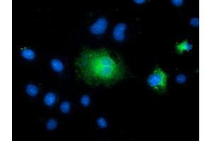 Anti-TCTN2 mouse monoclonal antibody (ABIN2453721) immunofluorescent staining of COS7 cells transiently transfected by pCMV6-ENTRY TCTN2 (RC203860). (TCTN2 抗体)