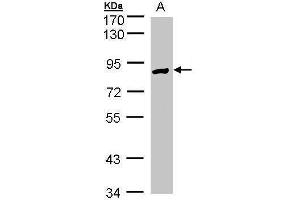 WB Image Sample(30 ug whole cell lysate) A:Hep G2 , 7. (Glucose-6-Phosphate Dehydrogenase 抗体)