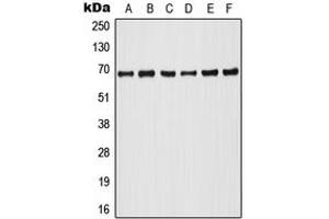 Western blot analysis of A-RAF (pY302) expression in HeLa PMA-treated (A), Raji (B), HT29 (C), NIH3T3 (D), SP2/0 PMA-treated (E), PC12 PMA-treated (F) whole cell lysates.