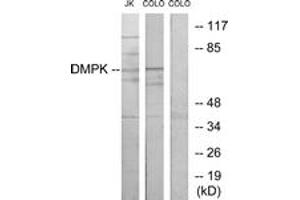 Western blot analysis of extracts from Jurkat/COLO205 cells, using DMPK Antibody. (DMPK 抗体  (AA 11-60))