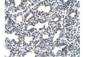 KCTD6 antibody was used for immunohistochemistry at a concentration of 16. (KCTD6 抗体  (N-Term))