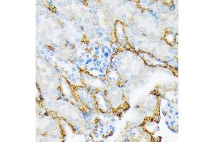 Immunohistochemistry of paraffin-embedded mouse kidney using Alpha-2-Macroglobulin (Alpha-2-Macroglobulin (M)) Rabbit mAb (ABIN7265558) at dilution of 1:100 (40x lens). (alpha 2 Macroglobulin 抗体)
