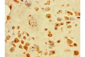 Immunohistochemistry of paraffin-embedded human placenta tissue using ABIN7173756 at dilution of 1:100 (TINAGL1 抗体  (AA 250-467))