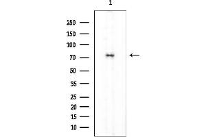 Western blot analysis of lysates from EC304 cells, using MeCP2 Mouse Monoclonal Antibody at 1/1000 dilution.