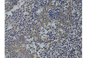 Immunohistochemistry of paraffin-embedded human tonsil using GNA15 antibody (ABIN1872841) at dilution of 1:100 (40x lens). (GNA15 抗体)