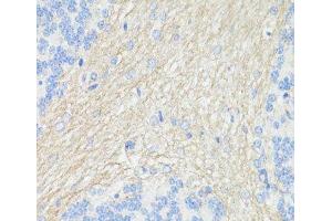 Immunohistochemistry of paraffin-embedded Rat brain using THY1 Polyclonal Antibody at dilution of 1:100 (40x lens). (CD90 抗体)