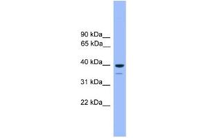 WB Suggested Anti-OR1C1 Antibody Titration: 1. (OR1C1 抗体  (C-Term))