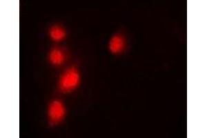 Immunofluorescent analysis of Pontin 52 staining in A549 cells. (RUVBL1 抗体)