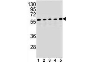 PAX1 antibody western blot analysis in (1) HepG2, (2) MDA-MB453, (3) 293, (4) K562 and (5) MCF-7 lysate. (PAX1 抗体  (AA 443-471))