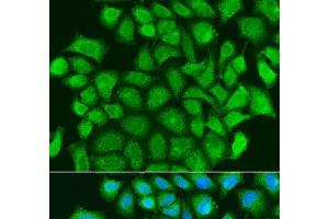 Immunofluorescence analysis of U2OS cells using TRAF3 Polyclonal Antibody at dilution of 1:100. (TRAF3 抗体)