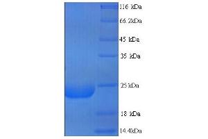 SDS-PAGE (SDS) image for Lymphocyte Antigen 6 Complex, Locus G6D (LY6G6D) (AA 20-104) protein (His tag) (ABIN4985063)