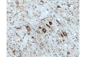Rat cerebellum, formalin-fixed paraffin embedded tissue, with citrate pre-treatment, 20X. (Gephyrin 抗体  (AA 569-726))