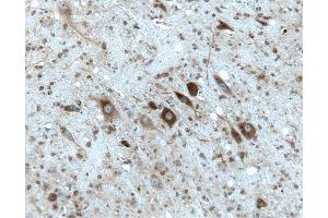 Rat cerebellum, formalin-fixed paraffin embedded tissue, with citrate pre-treatment, 20X. (Gephyrin 抗体  (AA 569-726))