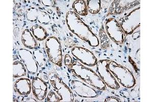 Image no. 5 for anti-Bruton Agammaglobulinemia tyrosine Kinase (BTK) antibody (ABIN1496974) (BTK 抗体)