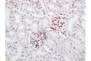 Formalin-fixed and paraffin embedded mouse kidney labeled with Rabbit Anti-PRMT6 Polyclonal Antibody, Unconjugated (ABIN761876) at 1:200 followed by conjugation to the secondary antibody and DAB staining (PRMT6 抗体  (AA 301-375))