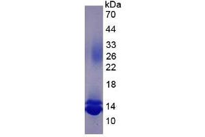 Image no. 2 for Chemokine (C-C Motif) Ligand 16 (CCL16) (AA 24-120) protein (His tag) (ABIN1980896)
