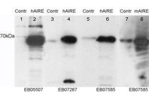 ABIN2560996 staining (0. (AIRE 抗体  (Internal Region, Isoform 1))