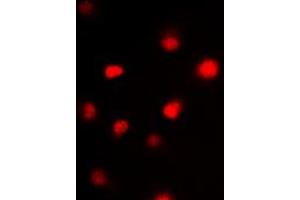 Immunofluorescent analysis of GATA3 staining in HeLa cells. (GATA3 抗体  (Center))