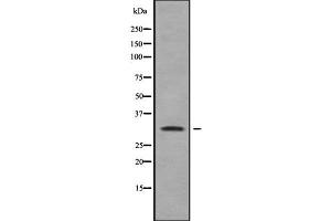 Western blot analysis of RAB40A using Jurkat whole cell lysates (RAB40A 抗体)