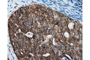 Immunohistochemical staining of paraffin-embedded Kidney tissue using anti-RALBP1 mouse monoclonal antibody. (RALBP1 抗体)