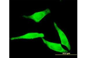 Image no. 1 for anti-5'-Nucleotidase, Cytosolic II (NT5C2) (AA 1-562) antibody (ABIN599188) (NT5C2 抗体  (AA 1-562))
