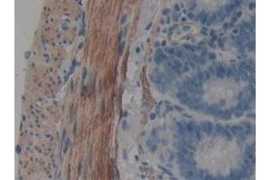DAB staining on IHC-P; Samples: Rat Intestine Tissue (WIF1 抗体  (AA 38-247))