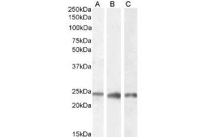 ABIN185610 (0. (PGRMC1 抗体  (C-Term))