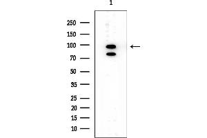 Western blot analysis of lysates from EC304 cells, using ABCC4 Mouse Monoclonal Antibody at 1/1000 dilution.