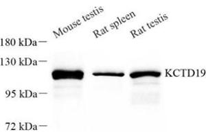 Western blot analysis of KCTD19 (ABIN7075147) at dilution of 1: 50 (KCTD19 抗体)