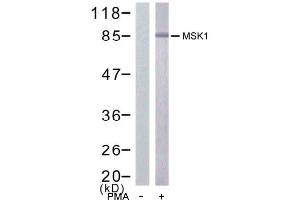 Image no. 1 for anti-Ribosomal Protein S6 Kinase, 90kDa, Polypeptide 5 (RPS6KA5) (Ser376) antibody (ABIN197422) (MSK1 抗体  (Ser376))