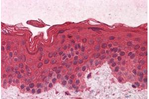 Immunohistochemistry (Formalin-fixed Paraffin-embedded Sections) (IHC (fp)) image for anti-Guanine Nucleotide Binding Protein (G Protein), alpha Inhibiting Activity Polypeptide 1 (GNAI1) (AA 1-355) antibody (ABIN574258)