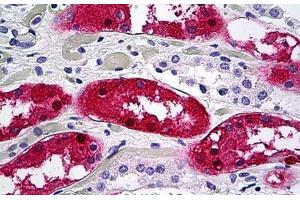Human Kidney, Tubules: Formalin-Fixed, Paraffin-Embedded (FFPE) (Aminoacylase 1 抗体  (AA 1-409))